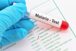 Malaria Test Done