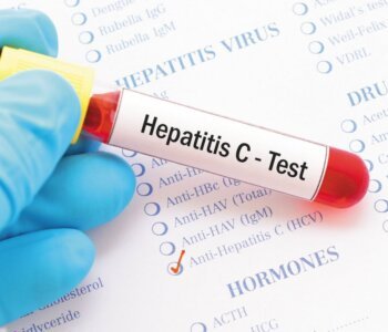 Hepatitis infection