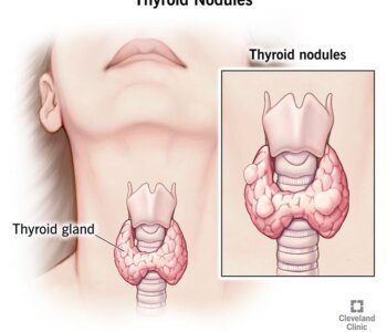Unusually tired after your workout? It might be time to check your thyroid.