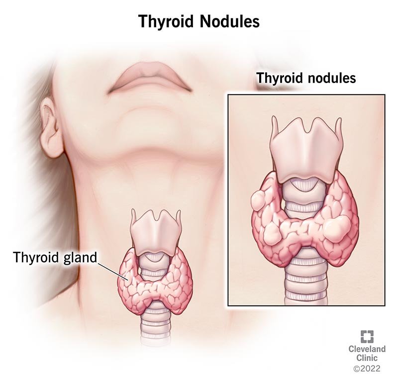 Unusually tired after your workout? It might be time to check your thyroid.